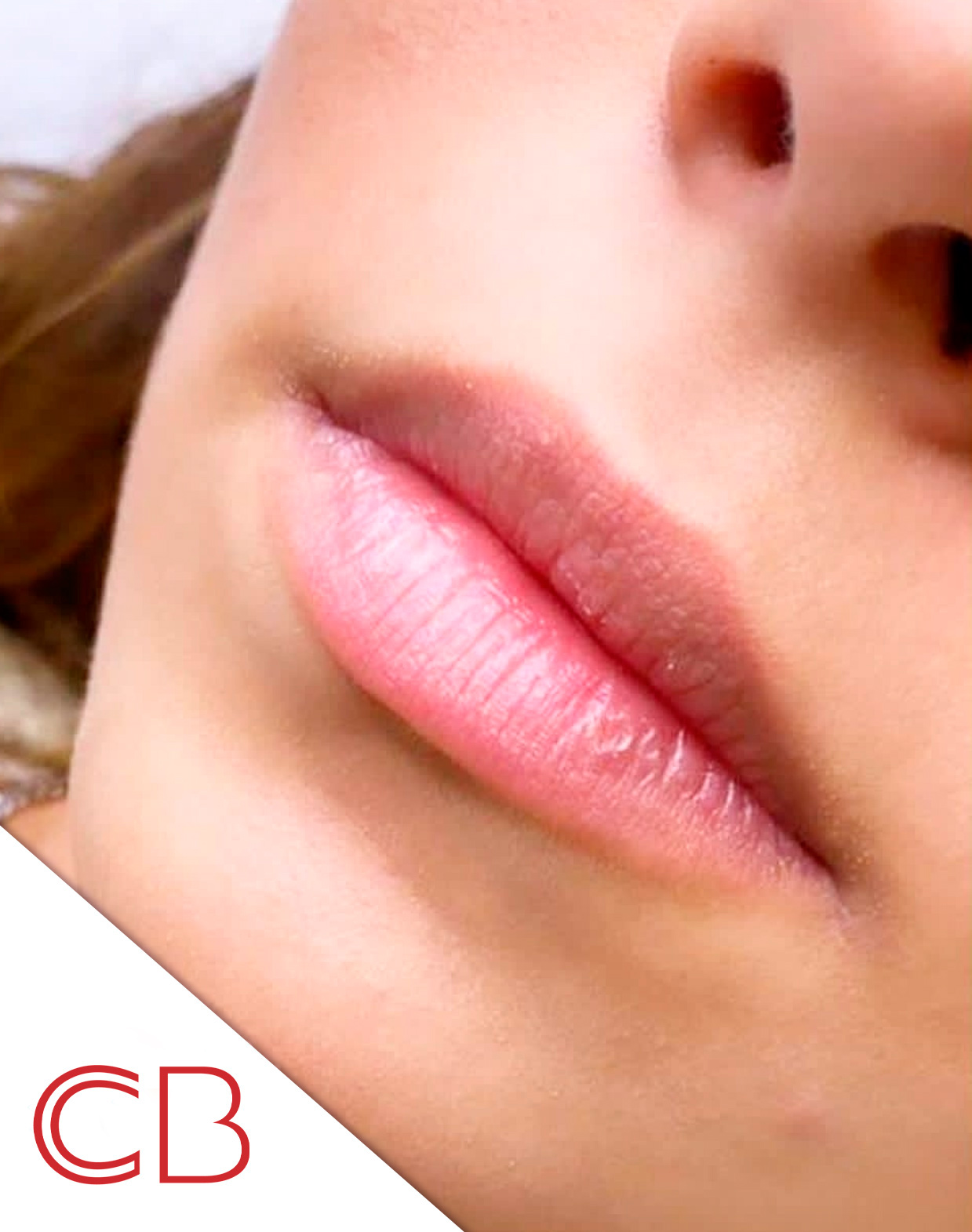 antes1 despues-labios-rusos--1